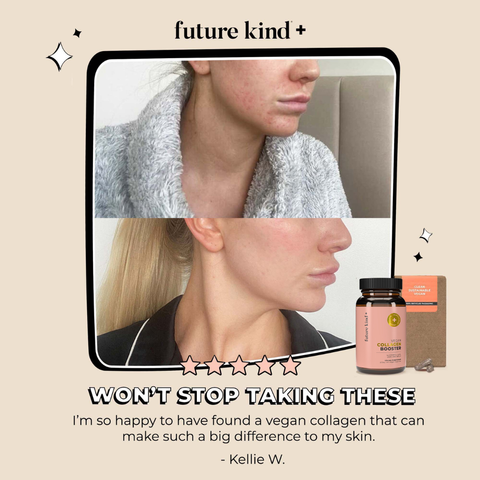 Vegan Collagen Booster Supplement