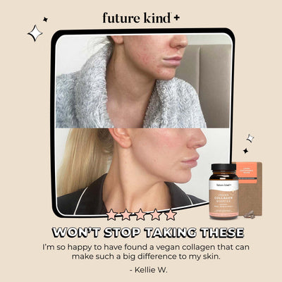 Future Kind Vegan Collagen Booster Supplement before & after skin